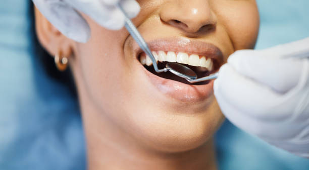Best Mobile Emergency Dentist in Kenwood, OH